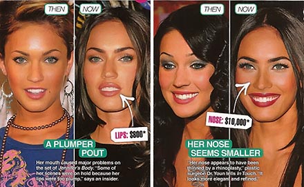 Megan Fox plastic surgery