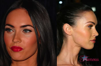 megan fox nose job