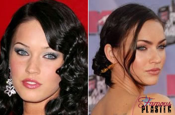 megan fox rhinoplasty