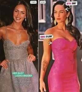 Megan Fox – pirms un pēc plastiskajām operācijām.