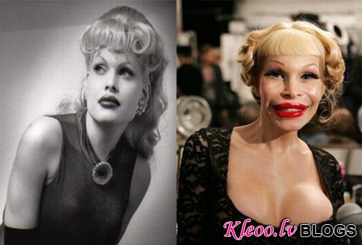 celebrity_plastic_surgery_640_03