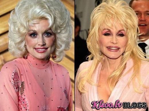 celebrities_before_and_after_plastic_surgery_13.jpg_1286983280