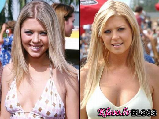 celebrities_before_and_after_plastic_surgery_18.jpg_1286983258