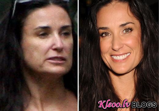 Demi-Moore-before-after-photos