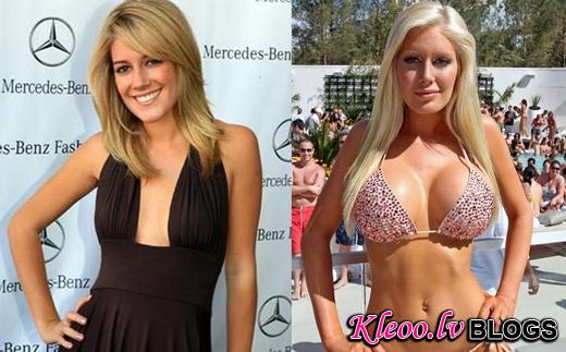 heidi-montag-before-after