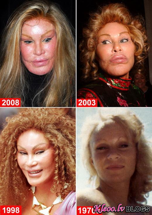 jocelyn-wildenstein