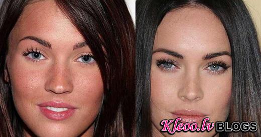 megan-fox-before-surgery